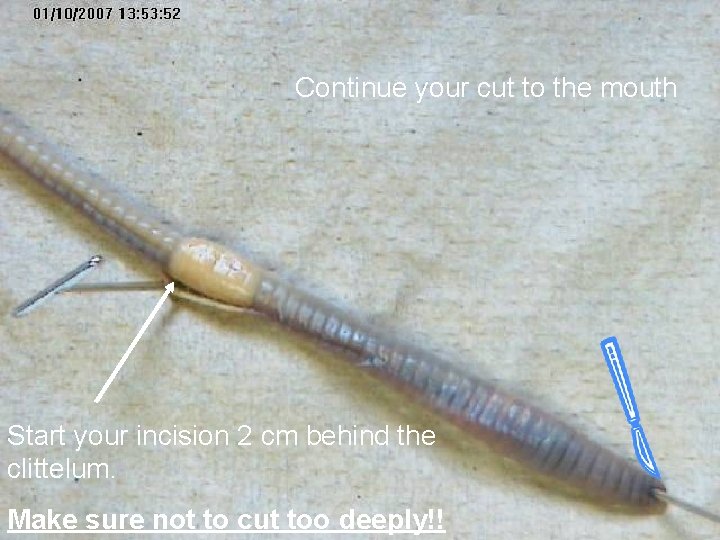 Continue your cut to the mouth Start your incision 2 cm behind the clittelum.