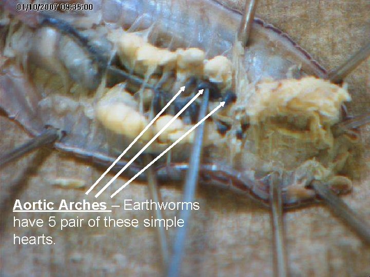 Aortic Arches – Earthworms have 5 pair of these simple hearts. 