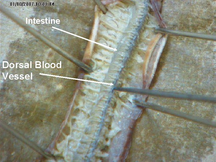 Intestine Dorsal Blood Vessel 