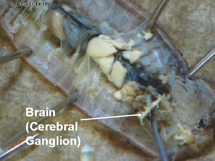 Brain (Cerebral Ganglion) 