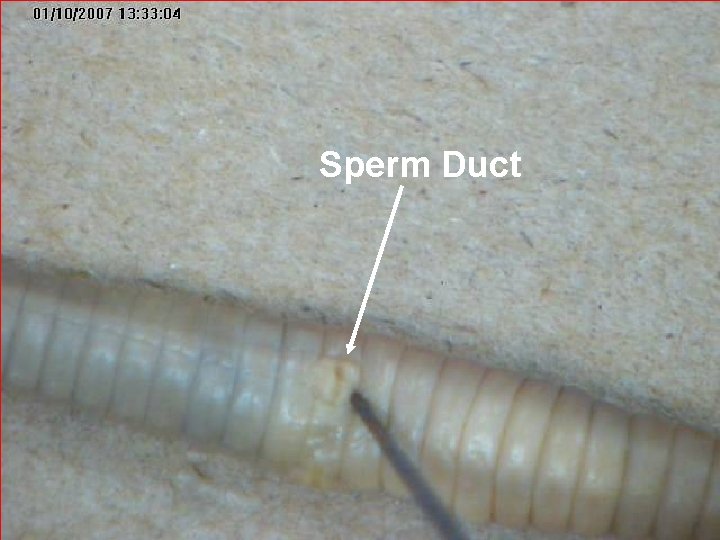 Sperm Duct 