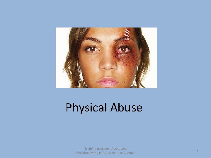Physical Abuse Training package: - Abuse and Whistleblowing of Abuse by Jade Claridge 6