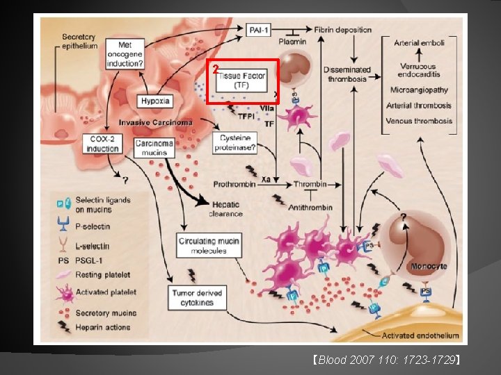2 【Blood 2007 110: 1723 -1729】 
