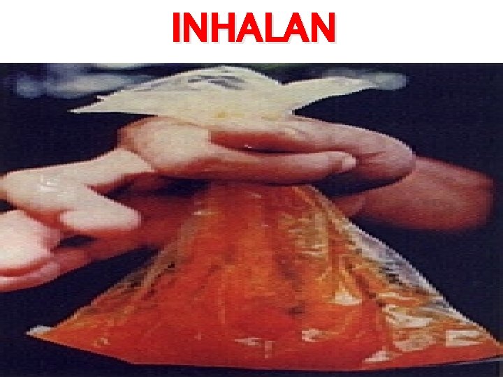 INHALAN 