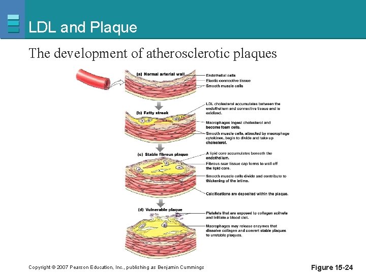 LDL and Plaque The development of atherosclerotic plaques Copyright © 2007 Pearson Education, Inc.