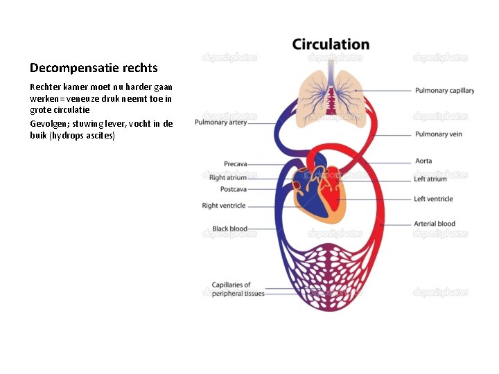 Decompensatie rechts Rechter kamer moet nu harder gaan werken= veneuze druk neemt toe in