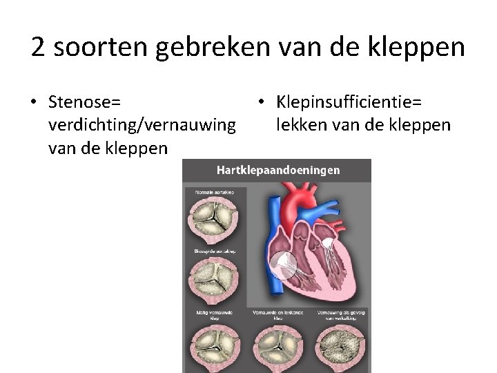 2 soorten gebreken van de kleppen • Stenose= verdichting/vernauwing van de kleppen • Klepinsufficientie=