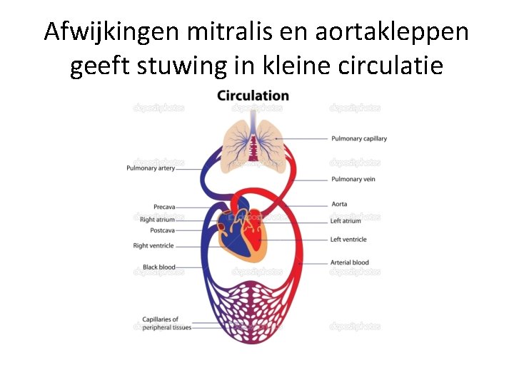 Afwijkingen mitralis en aortakleppen geeft stuwing in kleine circulatie 