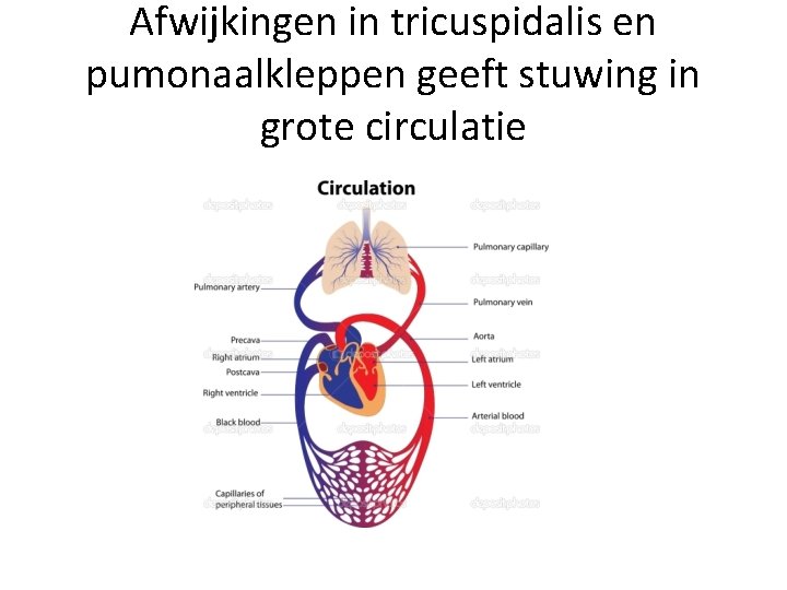 Afwijkingen in tricuspidalis en pumonaalkleppen geeft stuwing in grote circulatie 