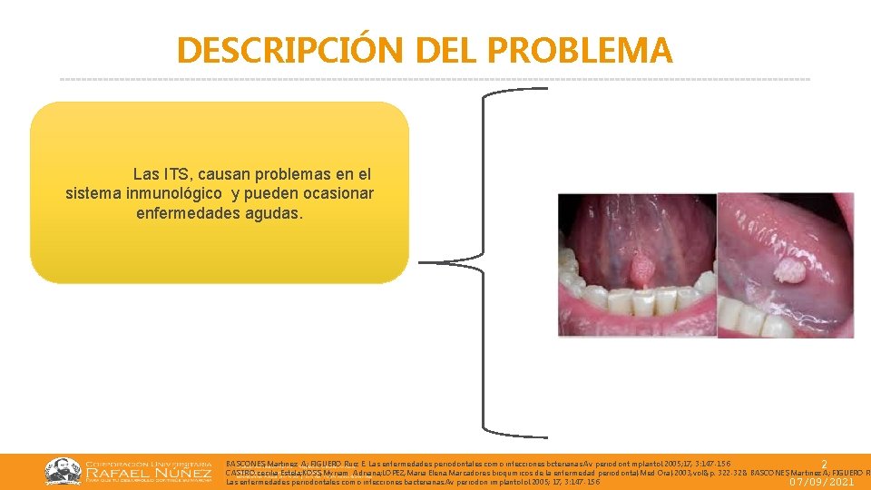 DESCRIPCIÓN DEL PROBLEMA Las ITS, causan problemas en el sistema inmunológico y pueden ocasionar