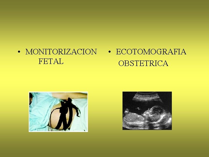  • MONITORIZACION FETAL • ECOTOMOGRAFIA OBSTETRICA 