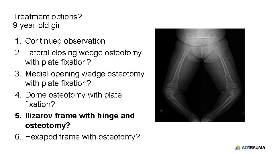 Treatment options? 9 -year-old girl 1. Continued observation 2. Lateral closing wedge osteotomy with