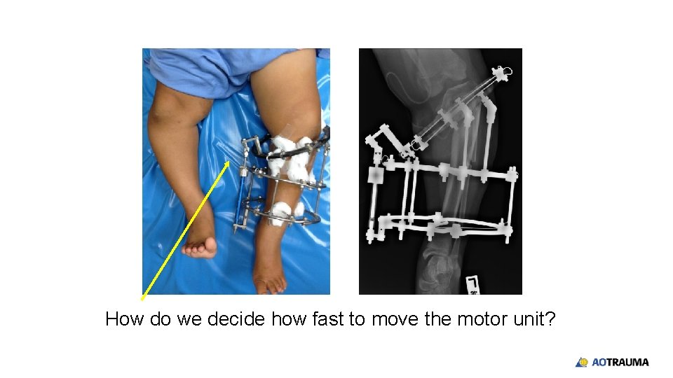 How do we decide how fast to move the motor unit? 