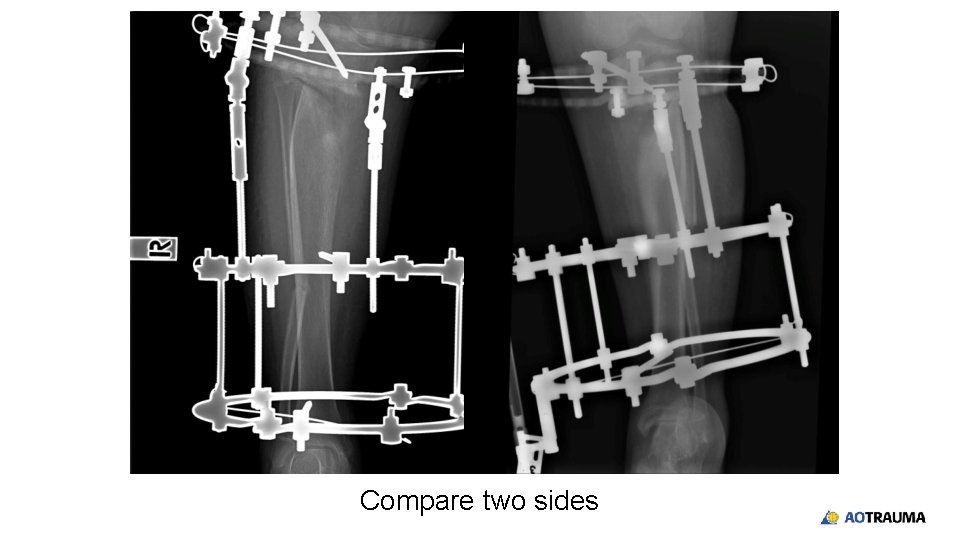 Compare two sides 