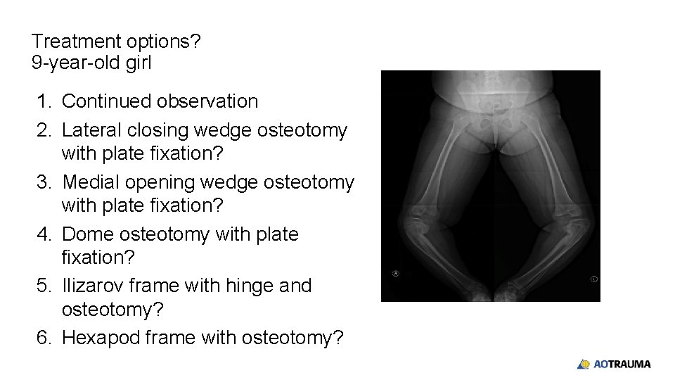 Treatment options? 9 -year-old girl 1. Continued observation 2. Lateral closing wedge osteotomy with