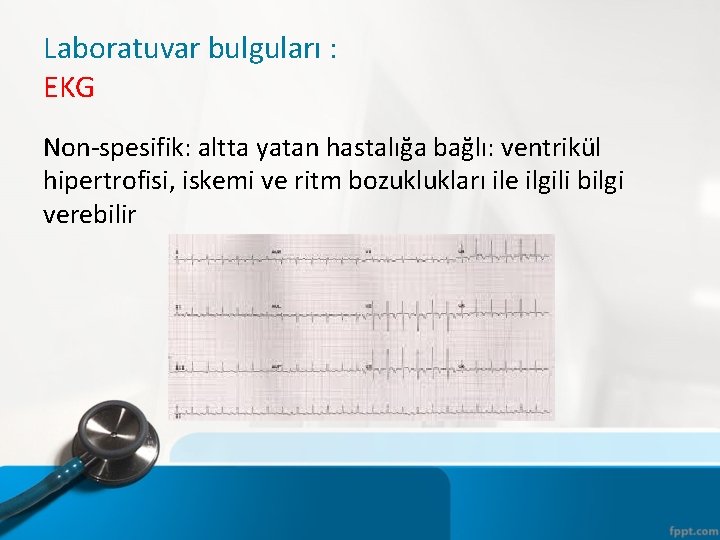 Laboratuvar bulguları : EKG Non-spesifik: altta yatan hastalığa bağlı: ventrikül hipertrofisi, iskemi ve ritm