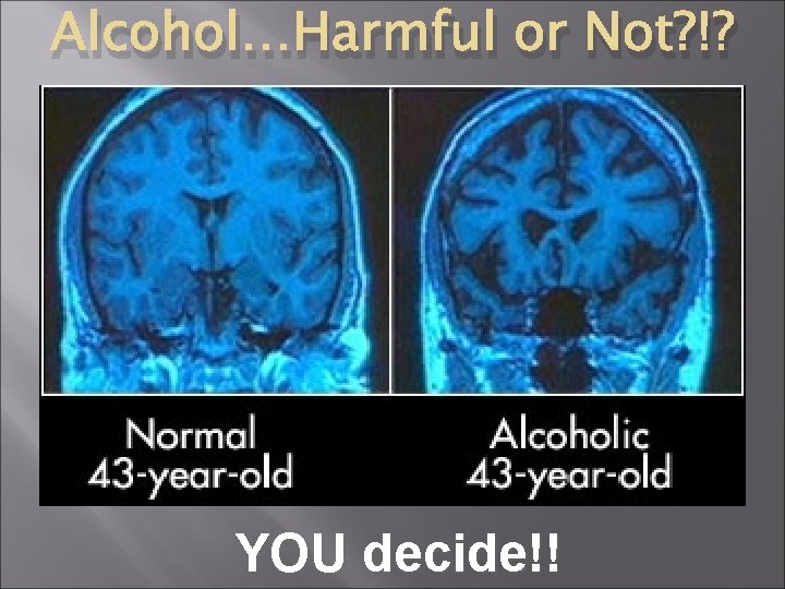 Alcohol…Harmful or Not? !? YOU decide!! 