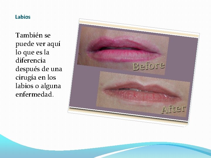 Labios También se puede ver aquí lo que es la diferencia después de una