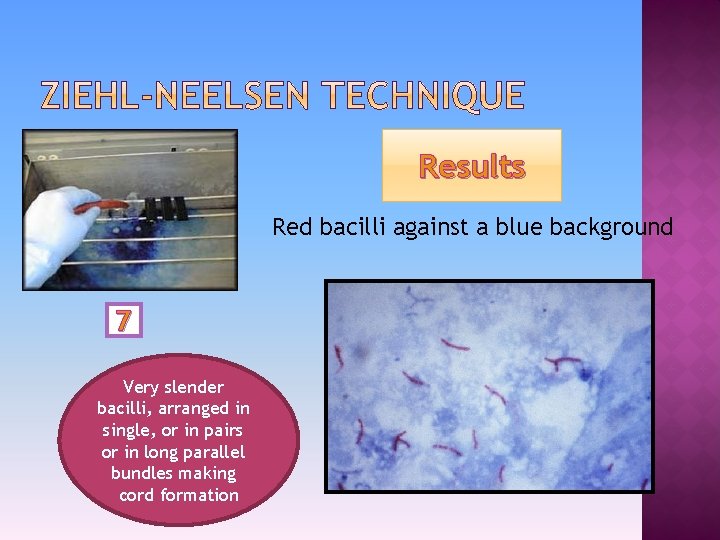 Results Red bacilli against a blue background 7 Very slender bacilli, arranged in single,