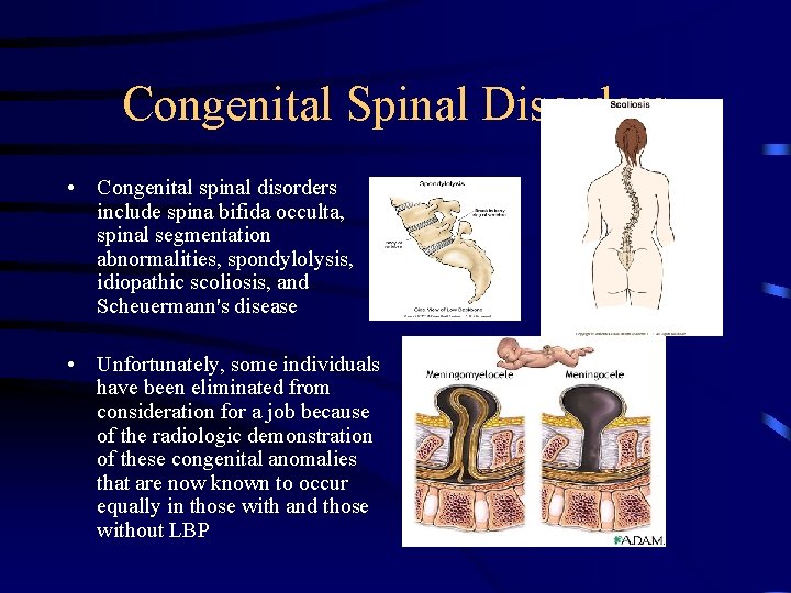 Congenital Spinal Disorders • Congenital spinal disorders include spina bifida occulta, spinal segmentation abnormalities,