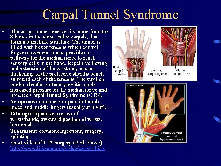 Carpal Tunnel Syndrome • • • The carpal tunnel receives its name from the