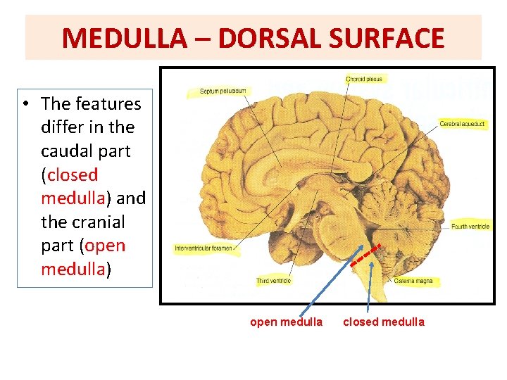 MEDULLA – DORSAL SURFACE • The features differ in the caudal part (closed medulla) MEDULLA – DORSAL SURFACE • The features differ in the caudal part (closed medulla)