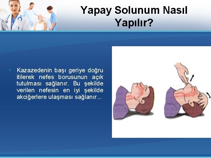 Yapay Solunum Nasıl Yapılır? • Kazazedenin başı geriye doğru itilerek nefes borusunun açık tutulması