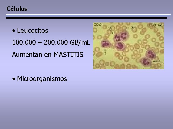 Células • Leucocitos 100. 000 – 200. 000 GB/m. L Aumentan en MASTITIS •