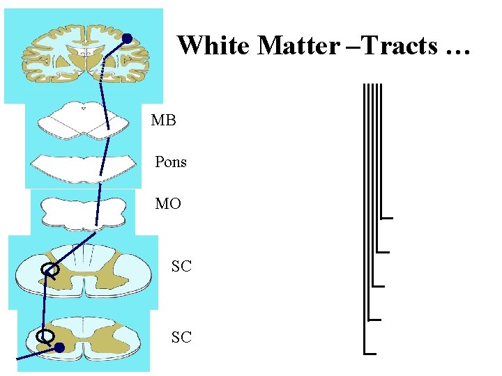White Matter –Tracts … MB Pons MO SC SC 