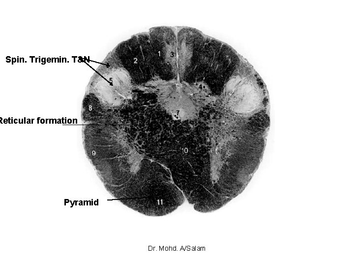 Spin. Trigemin. T&N Reticular formation Pyramid Dr. Mohd. A/Salam 