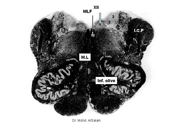 MLF XII I. C. P M. L Inf. olive Dr. Mohd. A/Salam 