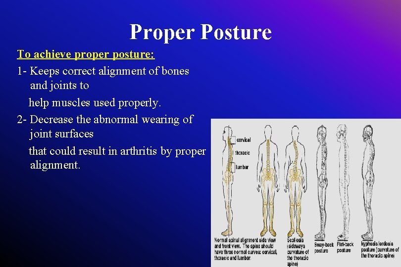 Proper Posture To achieve proper posture: 1 - Keeps correct alignment of bones and