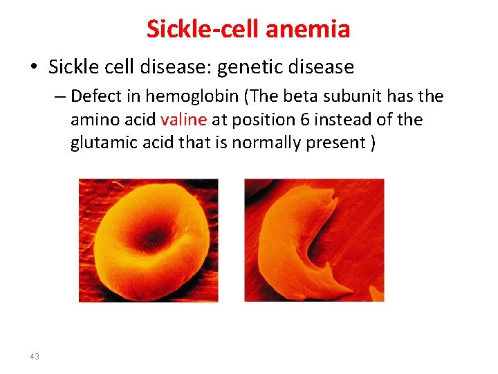 Sickle-cell anemia • Sickle cell disease: genetic disease – Defect in hemoglobin (The beta