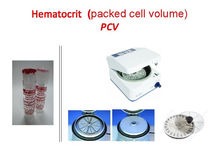 Hematocrit (packed cell volume) PCV 