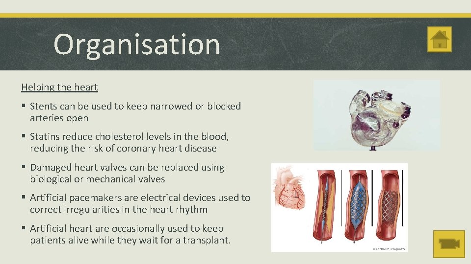 Organisation Helping the heart § Stents can be used to keep narrowed or blocked