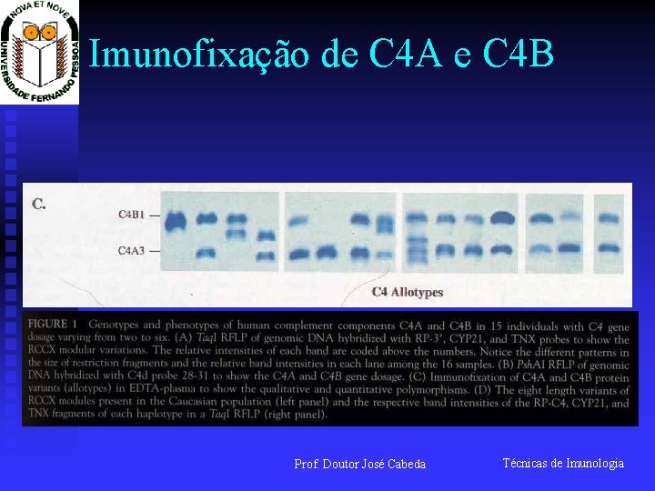 Imunofixação de C 4 A e C 4 B Prof. Doutor José Cabeda Técnicas