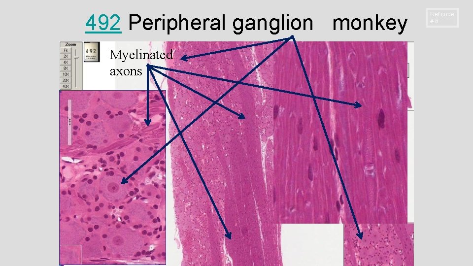 492 Peripheral ganglion monkey Myelinated axons Ref code #6 