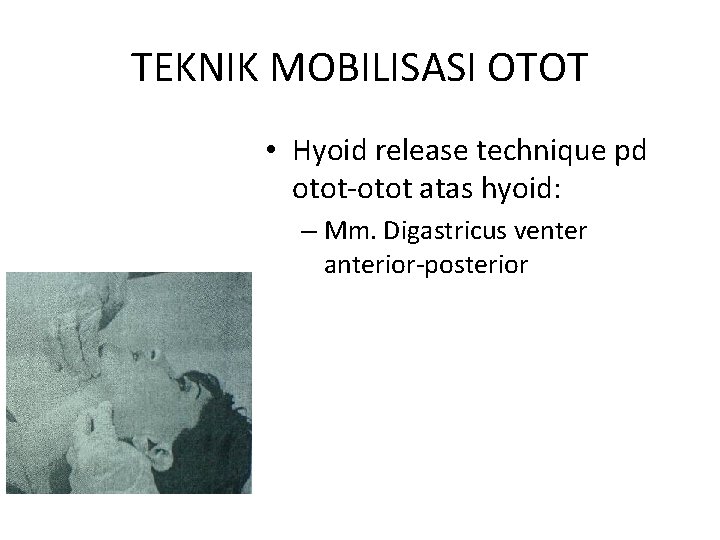 TEKNIK MOBILISASI OTOT • Hyoid release technique pd otot-otot atas hyoid: – Mm. Digastricus