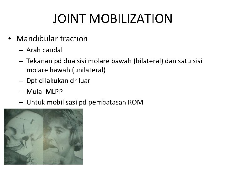 JOINT MOBILIZATION • Mandibular traction – Arah caudal – Tekanan pd dua sisi molare