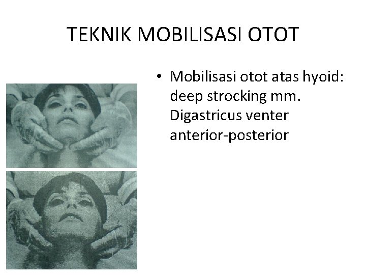 TEKNIK MOBILISASI OTOT • Mobilisasi otot atas hyoid: deep strocking mm. Digastricus venter anterior-posterior
