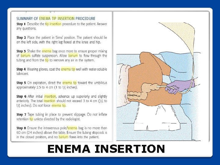 ENEMA INSERTION 