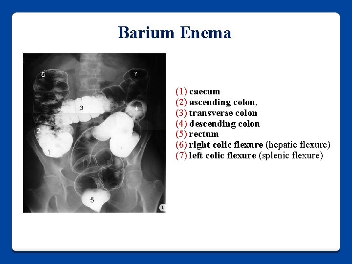 Barium Enema (1) caecum (2) ascending colon, (3) transverse colon (4) descending colon (5)