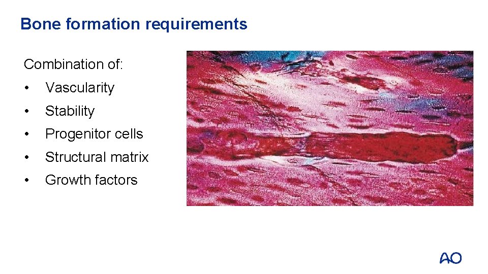 Bone formation requirements Combination of: • Vascularity • Stability • Progenitor cells • Structural