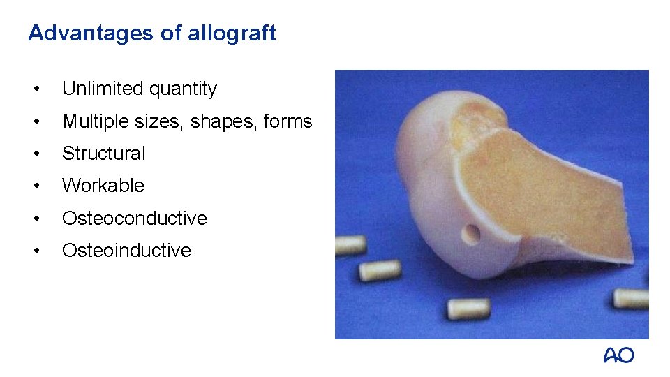 Advantages of allograft • Unlimited quantity • Multiple sizes, shapes, forms • Structural •