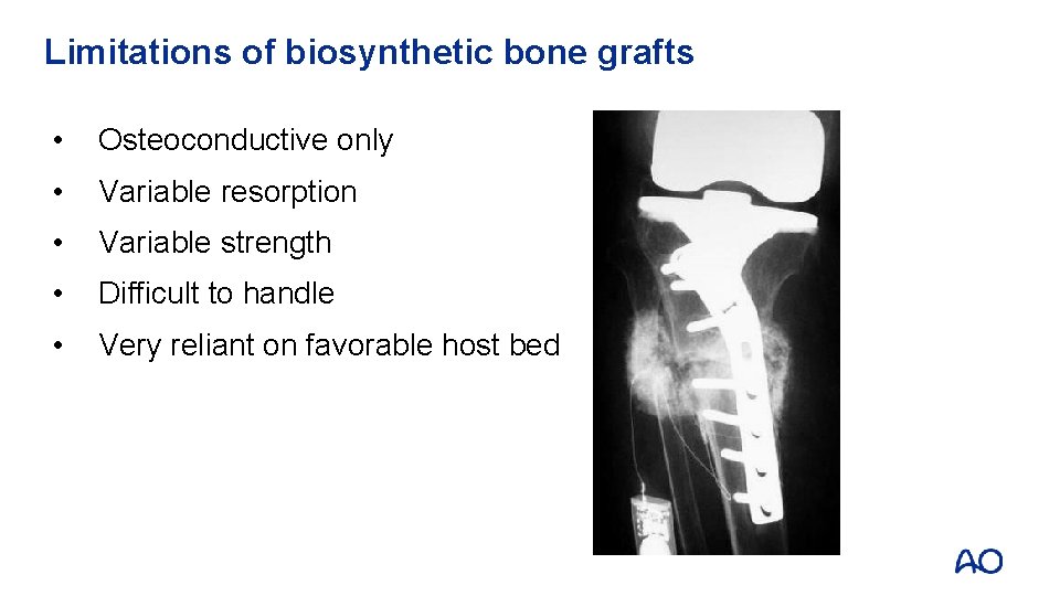 Limitations of biosynthetic bone grafts • Osteoconductive only • Variable resorption • Variable strength