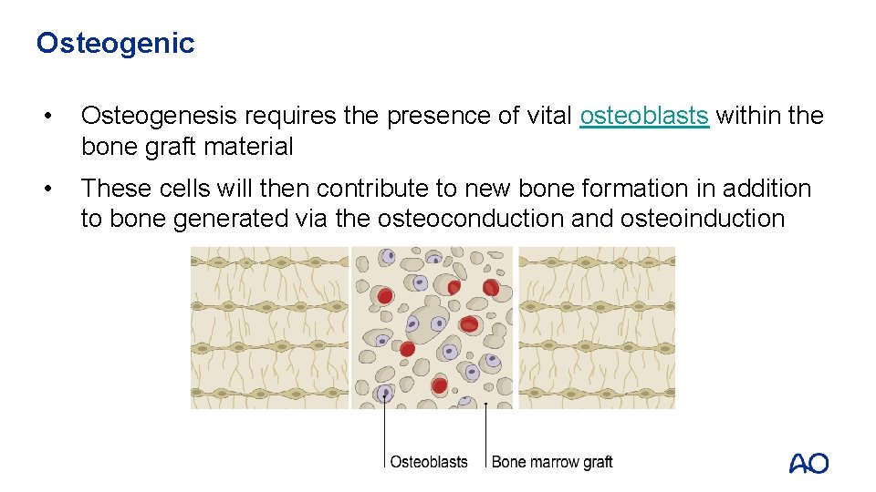 Osteogenic • Osteogenesis requires the presence of vital osteoblasts within the bone graft material
