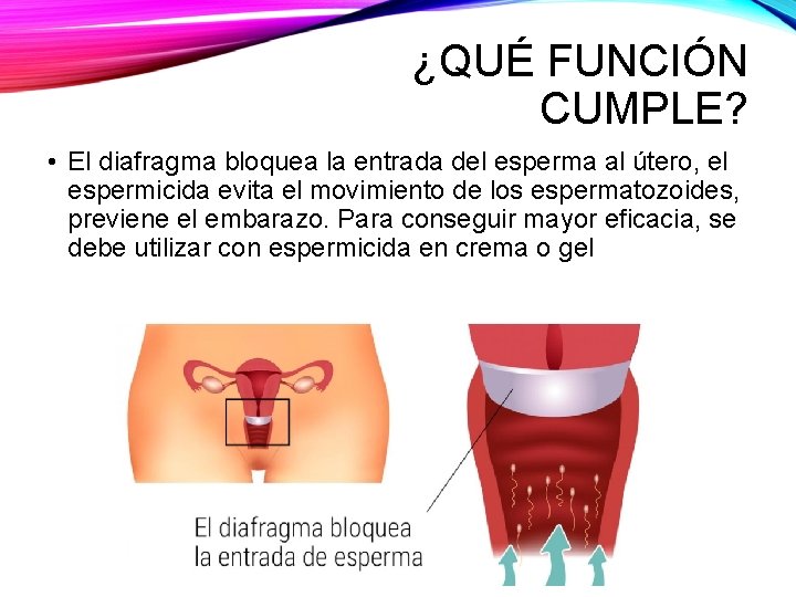 ¿QUÉ FUNCIÓN CUMPLE? • El diafragma bloquea la entrada del esperma al útero, el