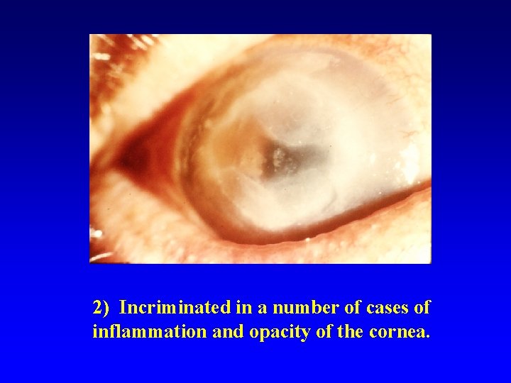 2) Incriminated in a number of cases of inflammation and opacity of the cornea.