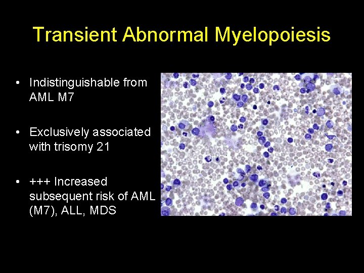Transient Abnormal Myelopoiesis • Indistinguishable from AML M 7 • Exclusively associated with trisomy