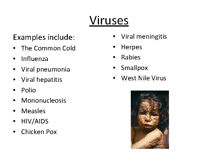 Viruses Examples include: • • • The Common Cold Influenza Viral pneumonia Viral hepatitis